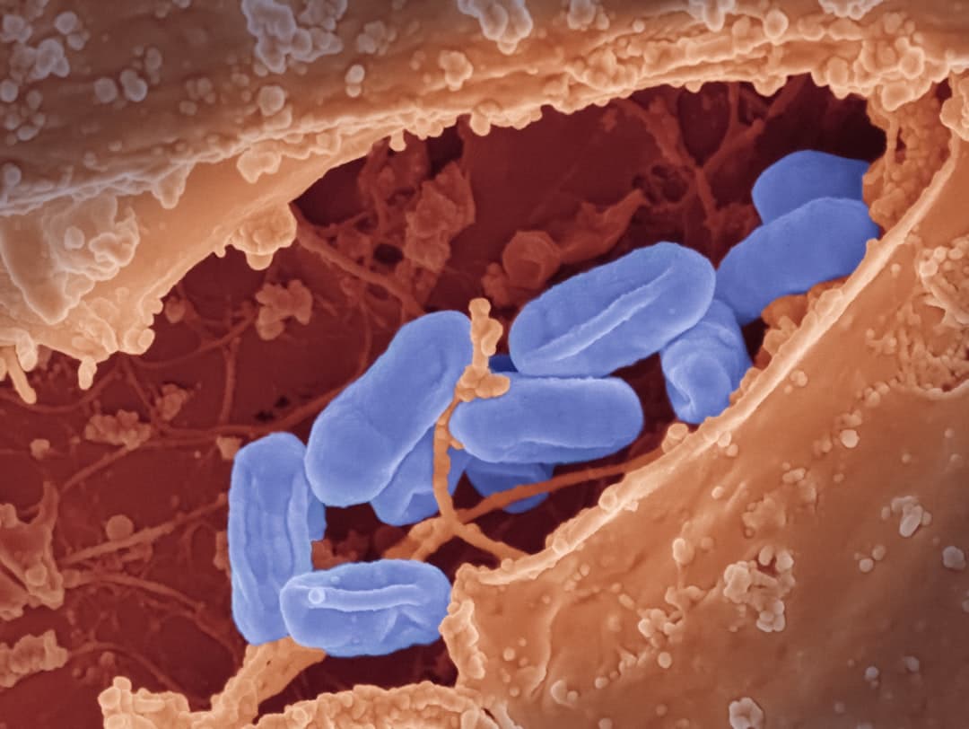 Rickettsia typhi Bacteria Scanning electron micrograph of Rickettsia typhi bacteria. Image captured at NIAID's Rocky Mountain Laboratories (RML) in Hamilton, Montana. Credit: NIAID https://www.flickr.com/photos/niaid/53316884049/